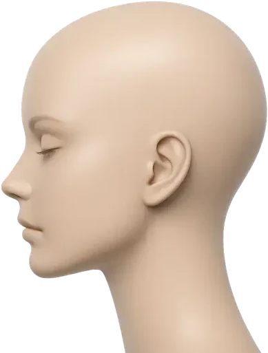 Illustration of the female crown and part line where stress-related thinning shows first